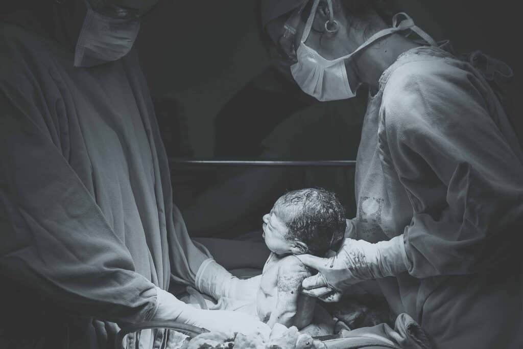 black and white photo of cesarean section