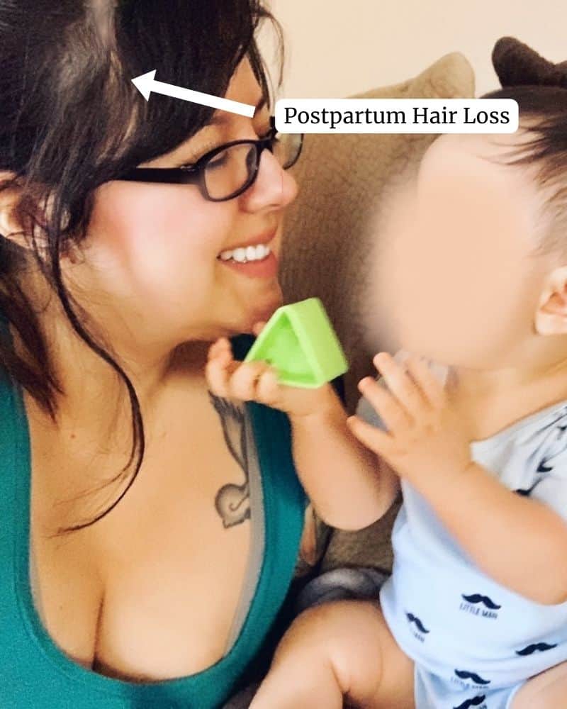 side profile of a myself (a mom) with my baby, an arrow is pointing to the area on my hair where I experienced hair thinning due to postpartum hair loss
